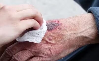 Tratar las heridas de un accidentado de tráfico