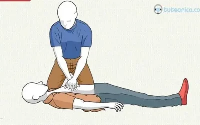 Cómo realizar la reanimación cardiopulmonar